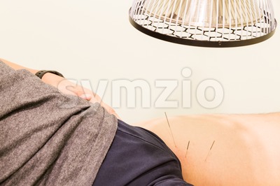 Closeup of acupuncture patient receiving treatment with infrared heat lamp Stock Photo