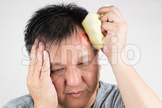 Man treating his injured painful swollen forehead bump with icepack Stock Photo