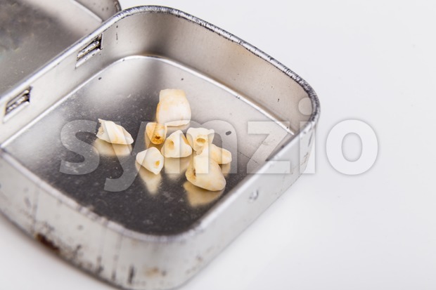 Collection of extracted milk teeth kept in box Stock Photo