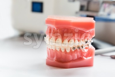 Orthodontics dental braces on teeth model to align teeth Stock Photo